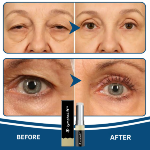 LymphaLift™ Eye Balm
