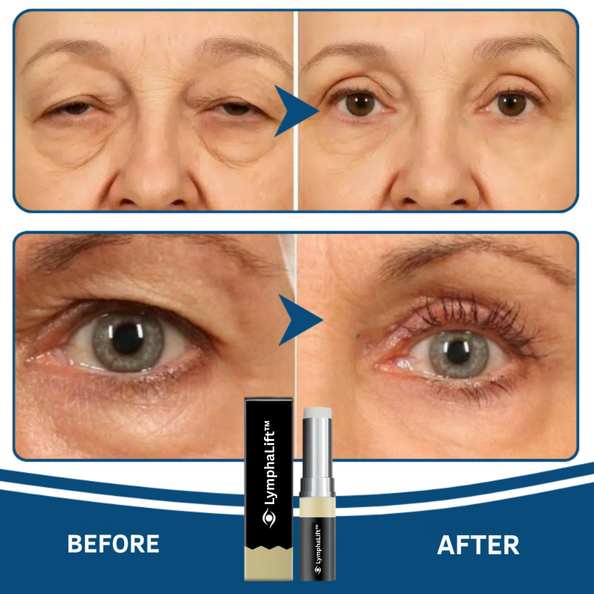 LymphaLift™ Eye Balm
