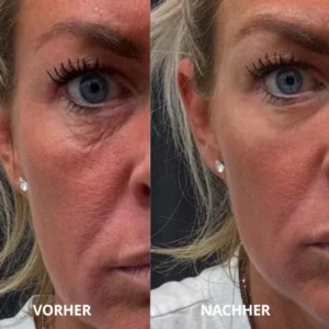 Luxevéria Die Peptid-Kollagen Hydrogel Augenpads