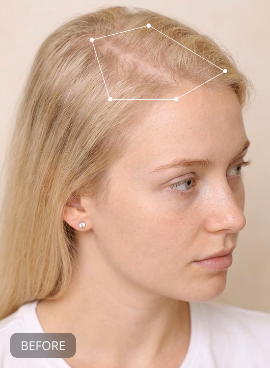 Firmora Labs Hair Growth Supplement for Women