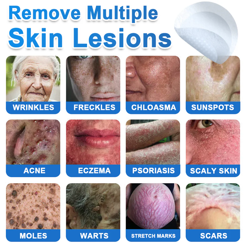 SkinPrikyn™ 2-in-1 Microneedle & Hydrocolloid Patch