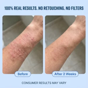 Neuvo Natural Relief Blend