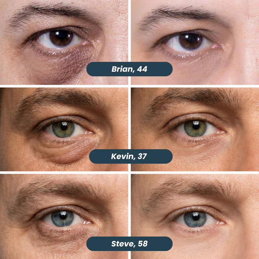 Orenã Microneedle Patches