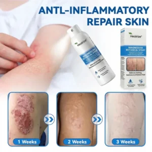 Healrize® Magnesium Botanical Spray