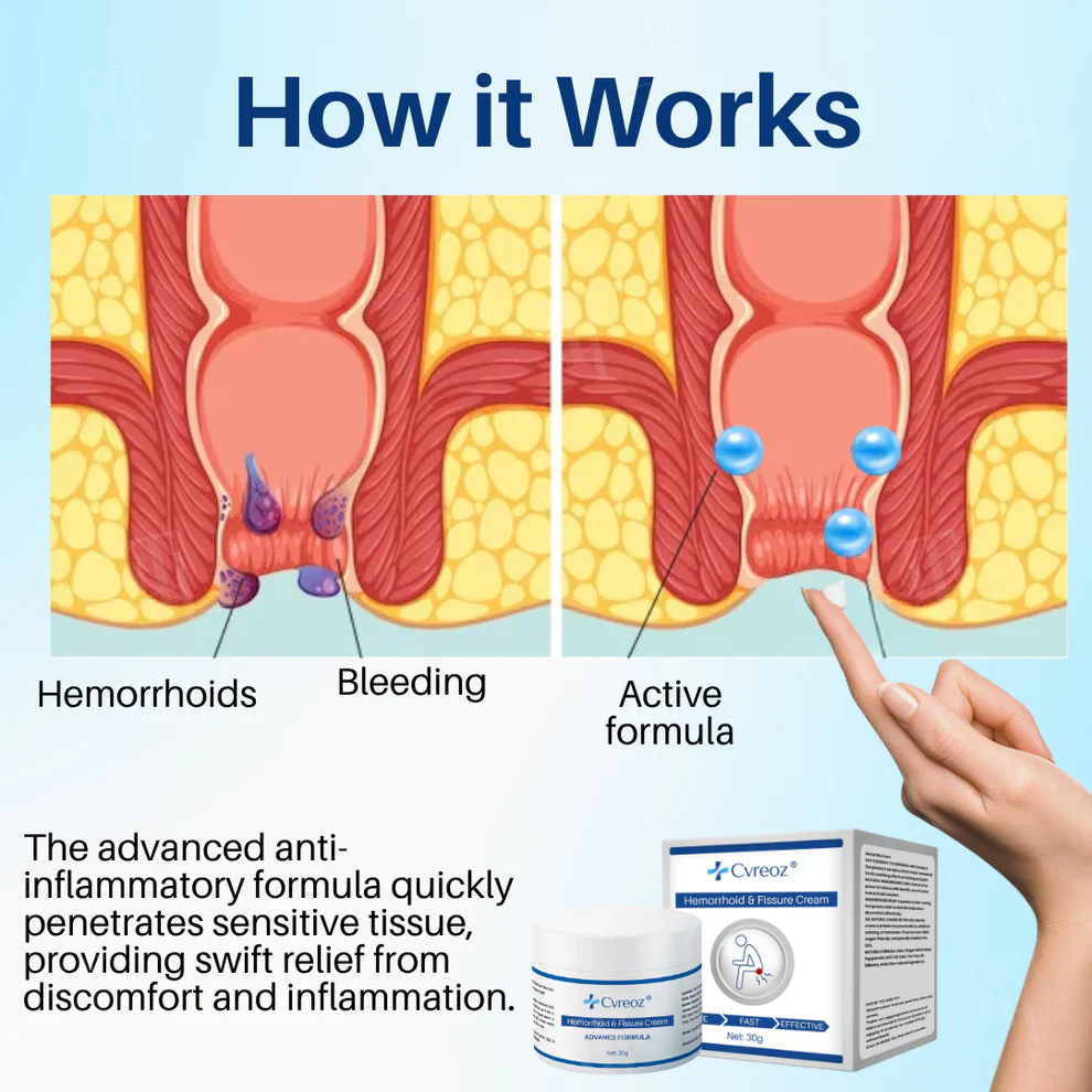 Cvreoz Hemorrhoid & Fissure Cream