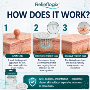 ReliefLogix Magnesium Microneedle Wart Removal Patch