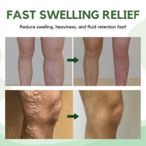 RZXEA™ Next-Gen Lymphatic Drainage & Vein Repair Cream