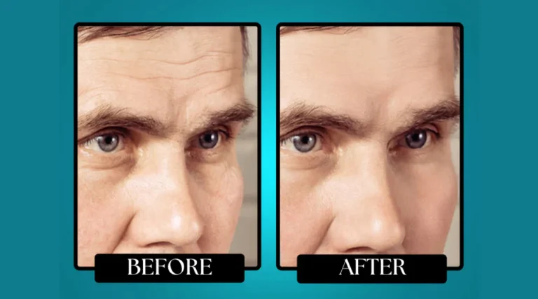 Morge™ Wrinkle Defense Tallow Balm