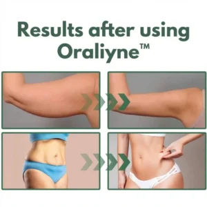 Oraliyne™ Firms and lifts sagging skin
